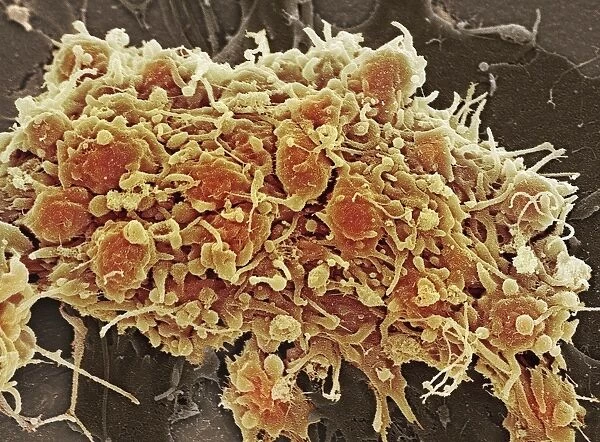 Platelets in a blood clot