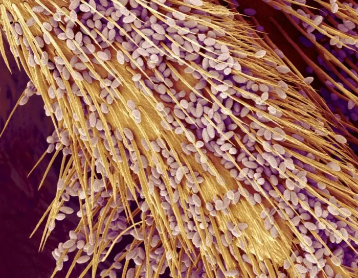 Framed Print : Coloured SEM Print of Pollen on Bee Leg Framed Print : Coloured SEM Print of Pollen on Bee Leg