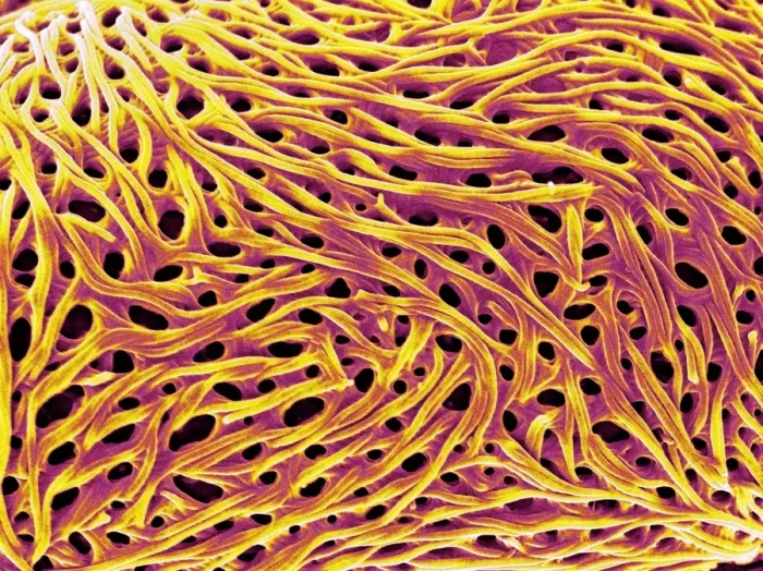 Framed Print : Pollen Grain Surface Print, SEM Framed Print : Pollen Grain Surface Print, SEM