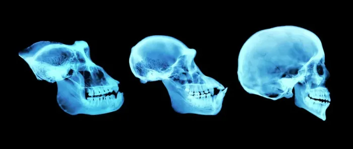 Framed Print : Coloured X-ray Print of Primate Skulls Framed Print : Coloured X-ray Print of Primate Skulls