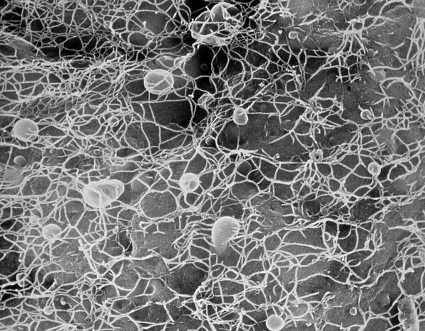 Protoplast showing cellulose microfibrils