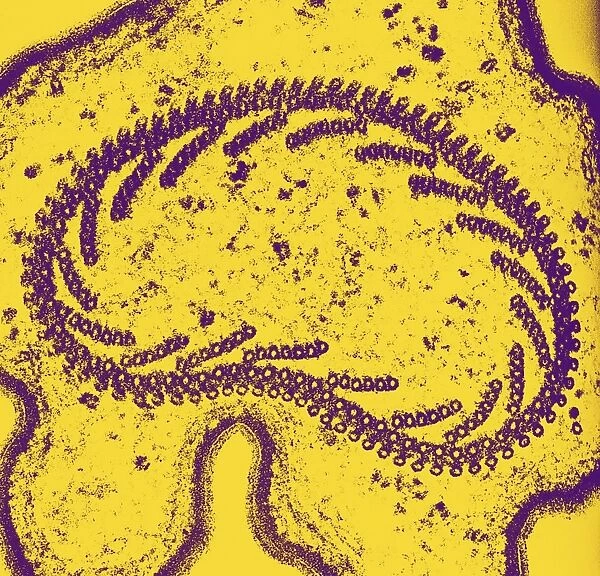 Protozoan tentacle, TEM