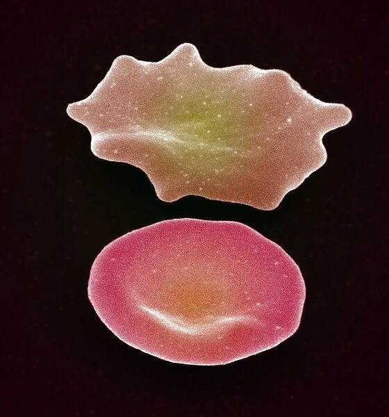 Red blood cell crenation, SEM