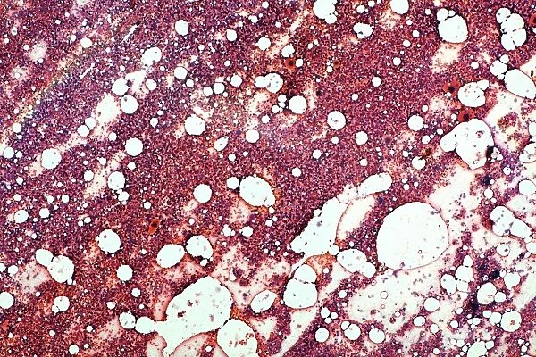Red bone marrow, light micrograph