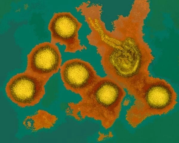 Rift Valley fever virus, TEM