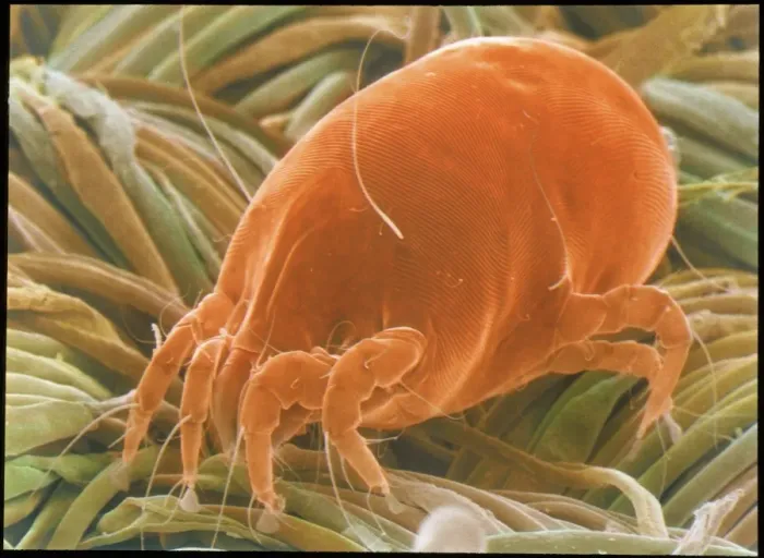 Framed Print : SEM Print of a Dust Mite Framed Print : SEM Print of a Dust Mite
