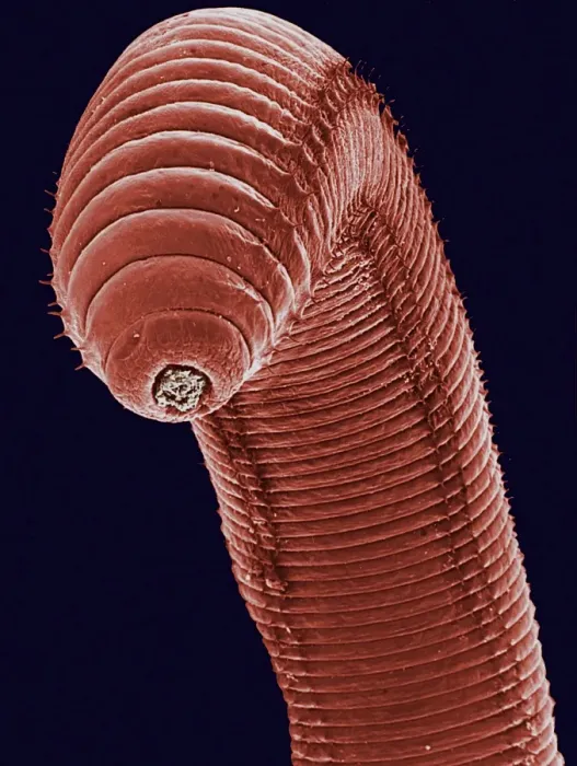 Framed Print : SEM Print of Earthworm Rear End Framed Print : SEM Print of Earthworm Rear End