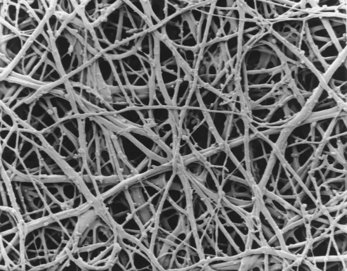 Framed Print : SEM Print of Hen Eggshell Internal Membrane Framed Print : SEM Print of Hen Eggshell Internal Membrane