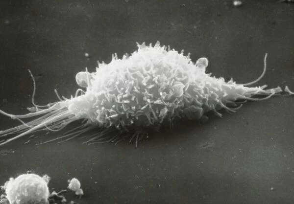 SEM of a macrophage cell moving over a surface