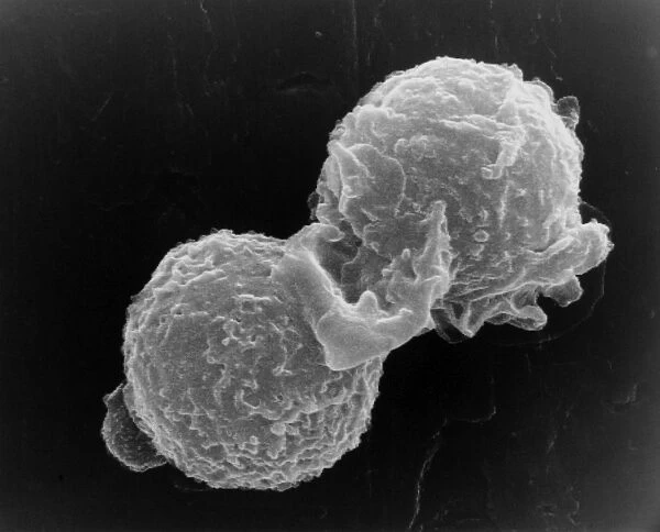 SEM of two polymorphonuclear white blood cells