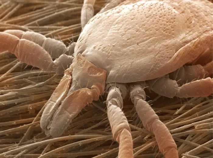 Framed Print : Sheep tick Print, SEM Image Framed Print : Sheep tick Print, SEM Image