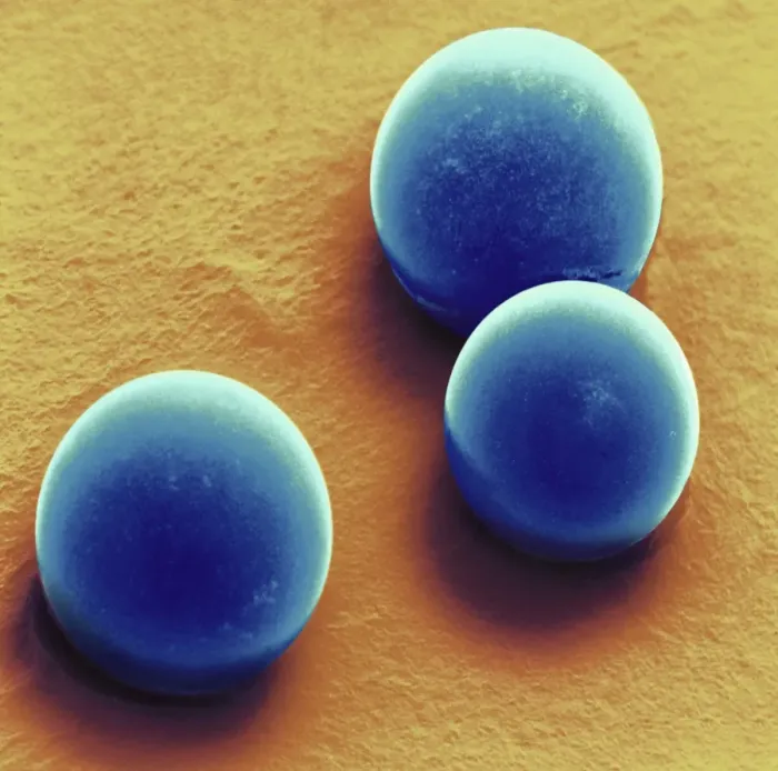 Framed Print : Silica microspheres Print, coloured SEM Framed Print : Silica microspheres Print, coloured SEM