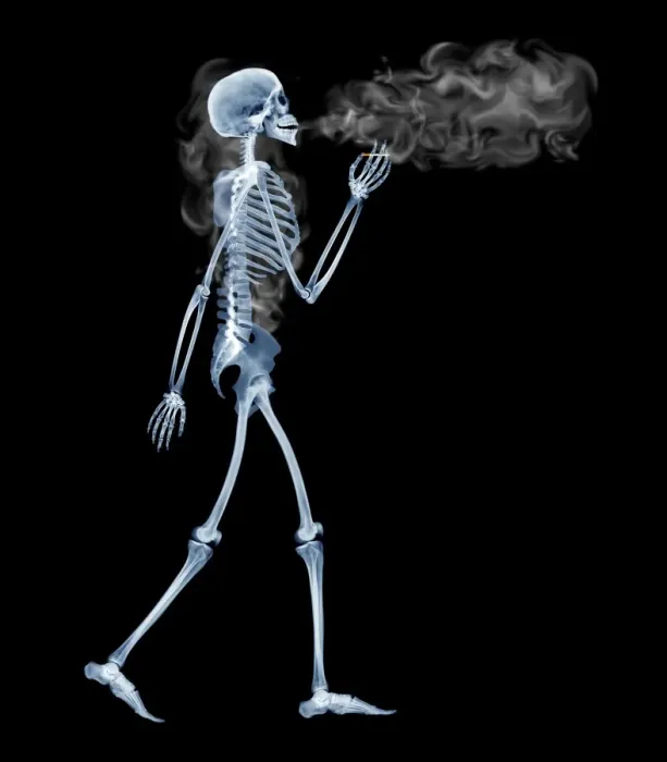 Framed Print : Computer-enhanced X-ray Print of a Skeleton Smoking Framed Print : Computer-enhanced X-ray Print of a Skeleton Smoking