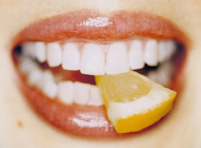 Framed Print : Slice of lemon between teeth Print Framed Print : Slice of lemon between teeth Print