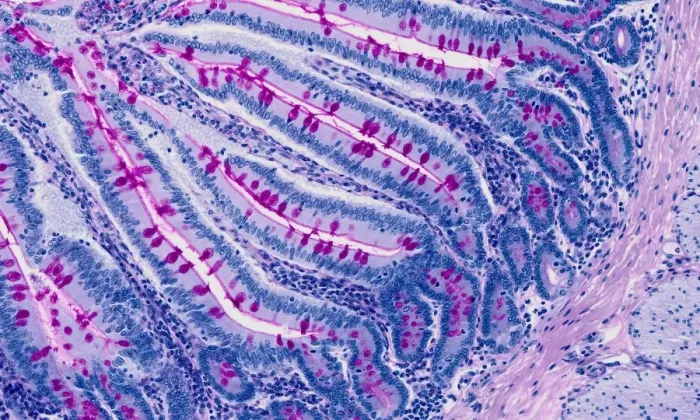 Framed Print : Small intestine print, light micrograph Framed Print : Small intestine print, light micrograph