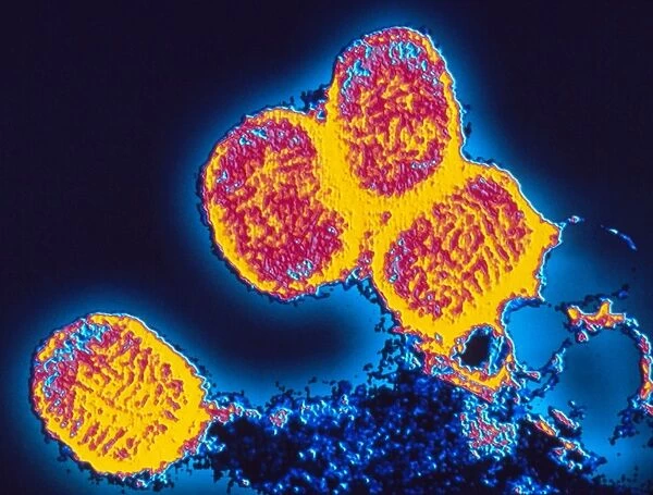 Smallpox variola viruses