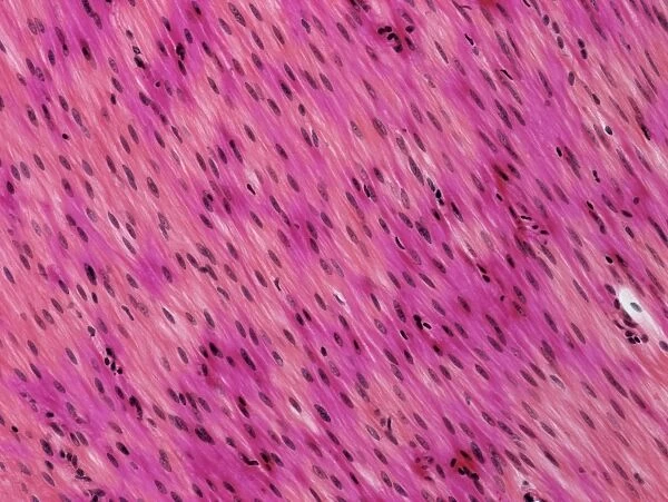 Smooth muscle, light micrograph