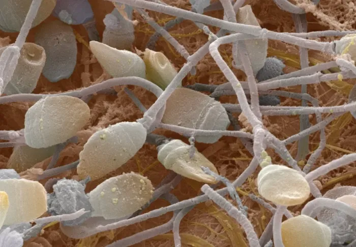 Framed Print : SEM Coloured Print of Human Sperm Framed Print : SEM Coloured Print of Human Sperm