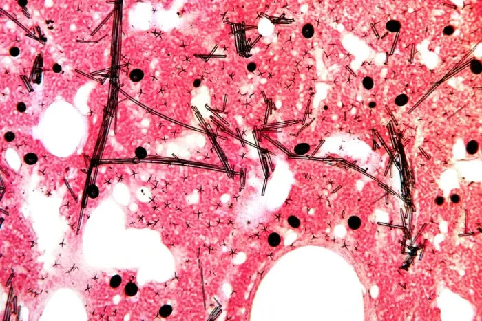 Framed Print : Print of Sponge Tissue, Light Micrograph Framed Print : Print of Sponge Tissue, Light Micrograph