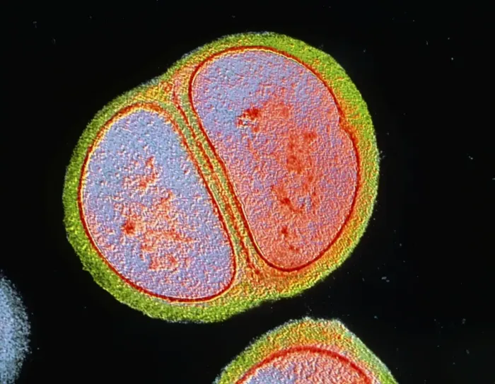 Framed Print : Staphylococcus epidermidis Bacterium Print Framed Print : Staphylococcus epidermidis Bacterium Print