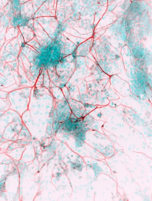 Framed Print : Stem Cell-Derived Neurons Print Framed Print : Stem Cell-Derived Neurons Print