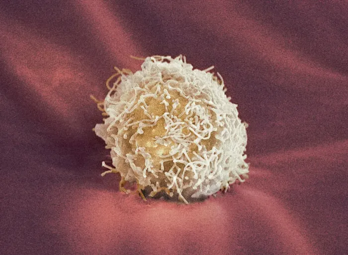 Framed Print : Stem Cell, SEM Print Framed Print : Stem Cell, SEM Print