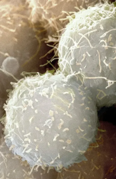 Framed Print : Stem cells, coloured SEM Print Framed Print : Stem cells, coloured SEM Print