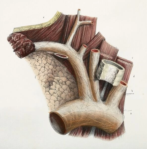 Subclavian artery nerves, 1844 artwork