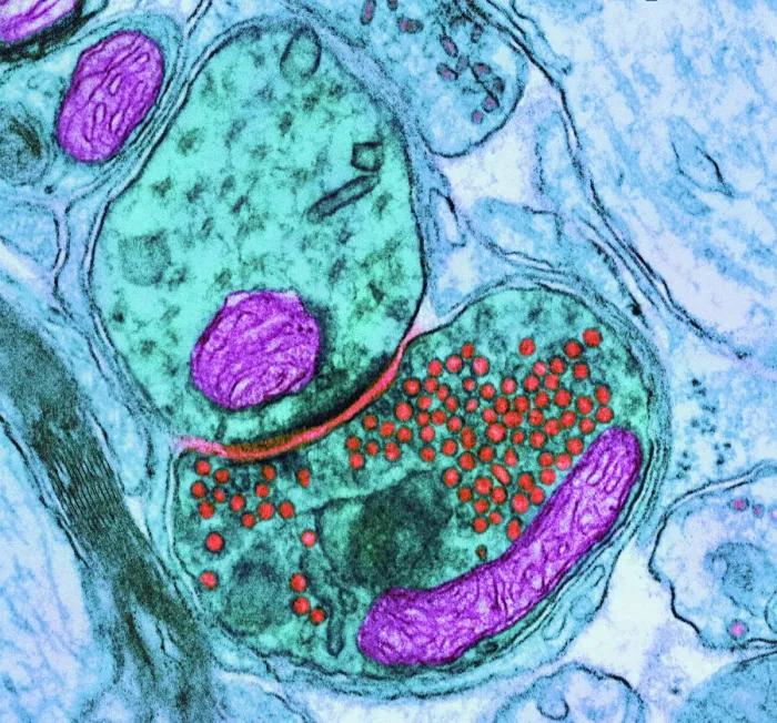 Framed Print : TEM Synapse Print: Nerve Cells and Vesicles