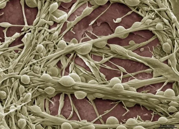 Framed Print : Synapse Nerve Junctions Print, Coloured SEM Framed Print : Synapse Nerve Junctions Print, Coloured SEM