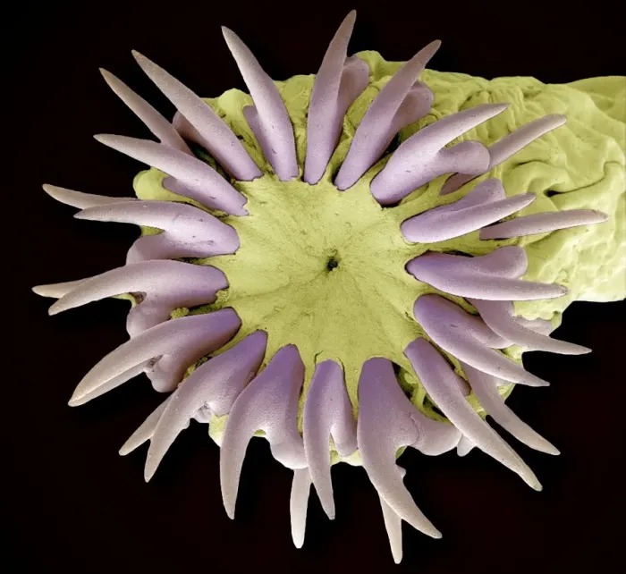 Framed Print : Tapeworm head, SEM Print Framed Print : Tapeworm head, SEM Print