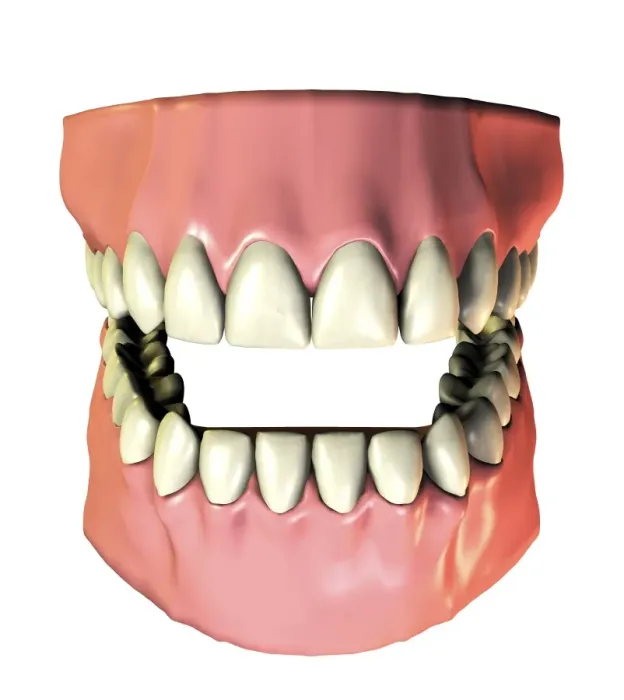 Framed Print : 32 Permanent Teeth Print - Computer artwork of healthy teeth and gums Framed Print : 32 Permanent Teeth Print - Computer artwork of healthy teeth and gums