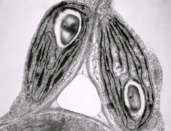 Framed Print : Transmission Electron Micrograph Print of Variegated Chloroplasts Framed Print : Transmission Electron Micrograph Print of Variegated Chloroplasts