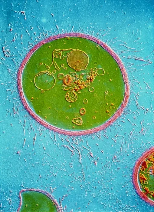 Framed Print : TEM Print of Encapsulated Yeast Cell Framed Print : TEM Print of Encapsulated Yeast Cell