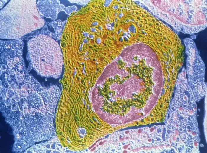 Framed Print : Human Plasmocyte TEM Print Framed Print : Human Plasmocyte TEM Print
