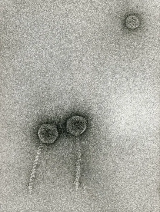 Framed Print : Lambda Bacteriophages Print Framed Print : Lambda Bacteriophages Print