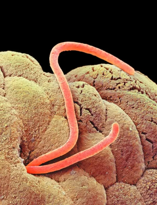 Framed Print : Threadworms in the gut Print, SEM Image Framed Print : Threadworms in the gut Print, SEM Image