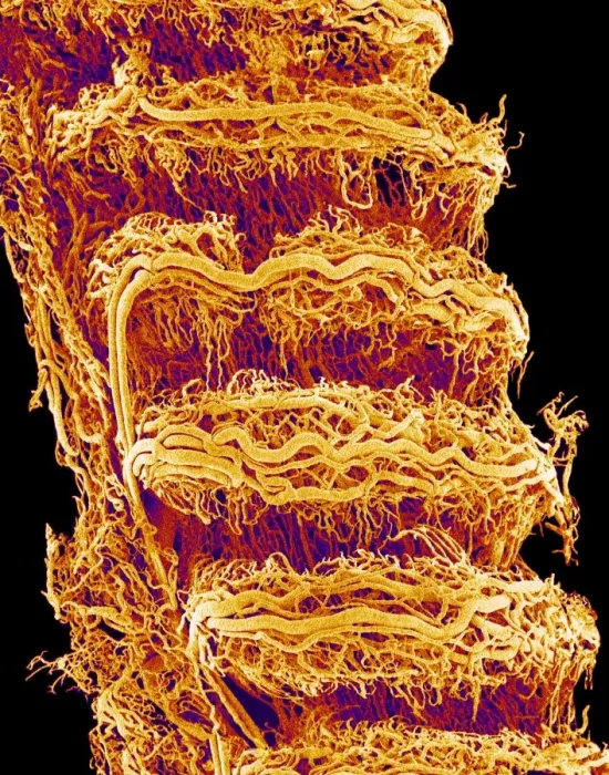 Framed Print : Trachea Print: Coloured SEM of the exterior Framed Print : Trachea Print: Coloured SEM of the exterior