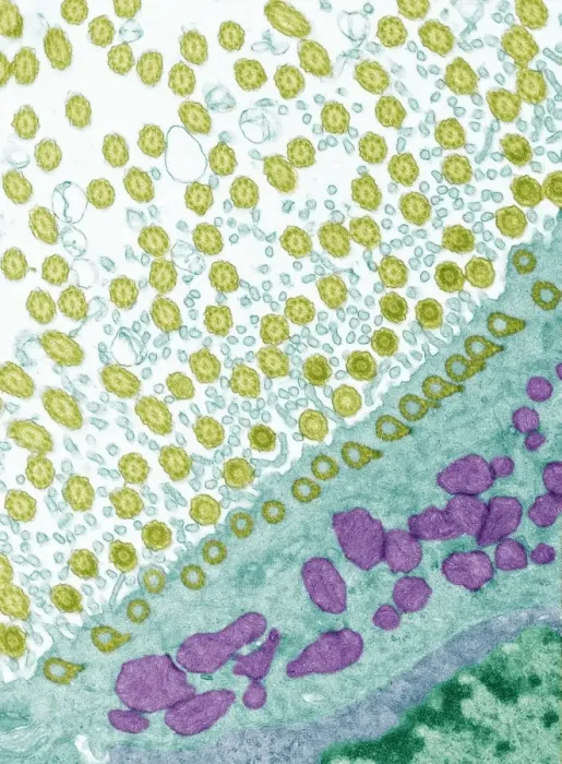 Framed Print : Trachea lining Print, TEM x7000 magnification