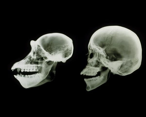 X-ray of human and chimpanzee skulls