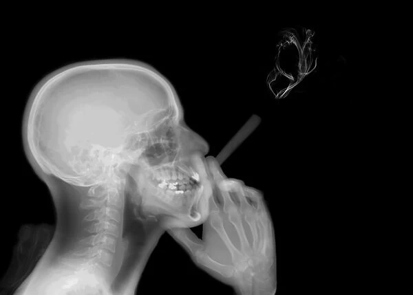 X-ray of a man smoking a cigarette