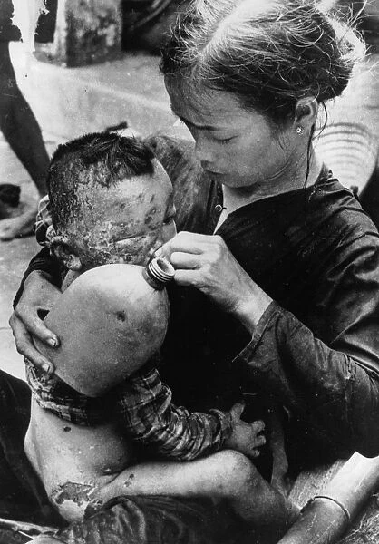 Vietnam, South, Cam Che, Badly burned Vietnamese baby caught in bursting Napalm bomb