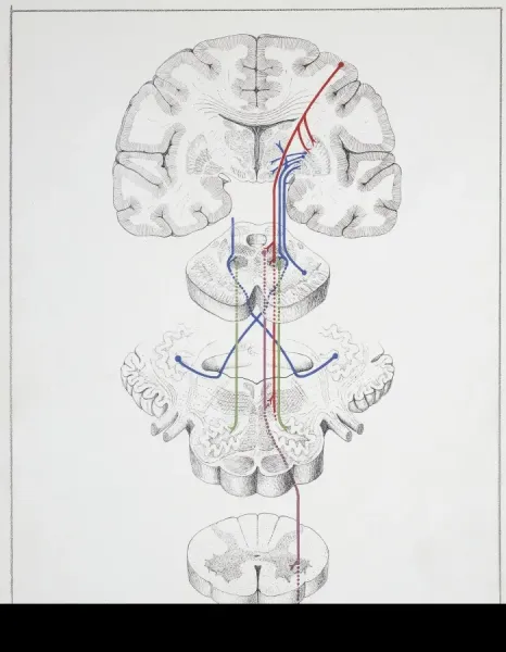 Extrapyramidal Tract Extrapyramidal System | Radiology Reference