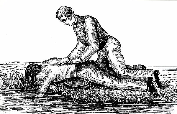 Engraving depicting a man trying to resuscitate a drowning victim by pressing on their back to drain water from the lungs and stomach, 19th century