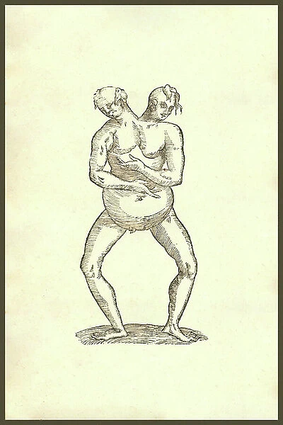 Monstrum hermaphroditicum biceps aliud, 1642 (engraving)