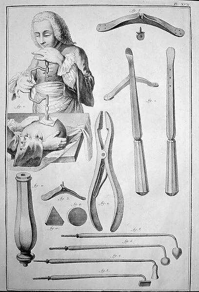 Trepanation of the skull, various instruments (engraving, 1772)