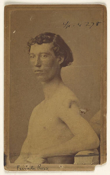 Private Ross Civil War victim Attributed William H