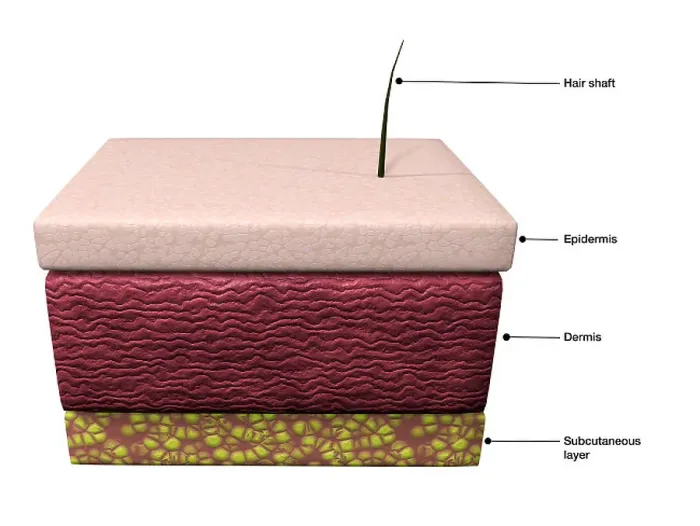 Framed Print : Human Skin Layers Print: Epidermis, Dermis, and Subcutaneous Tissue