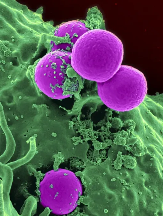 Framed Print : Scanning Electron Micrograph Print of Neutrophil Ingesting MRSA Bacteria Framed Print : Scanning Electron Micrograph Print of Neutrophil Ingesting MRSA Bacteria