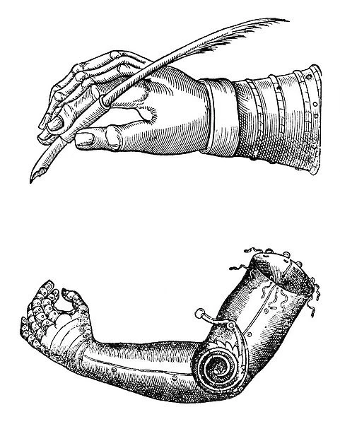 Artificial limbs, 1510-1590 (1956)